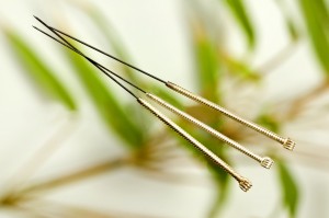 West Hollywood Acupuncture Treatments